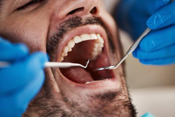 Best Knocked-Out Tooth Emergency  in Questa, NM